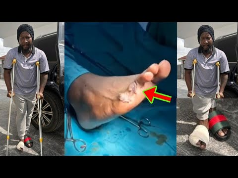 Read more about the article Sonnie Badu Acc!dent, His Two Toes Was Ch0pped Off As He Sh0ws It On National Television